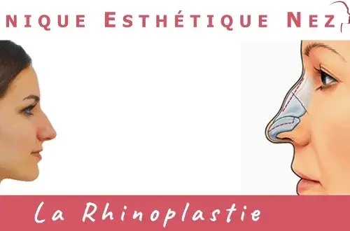 Rhinoplastie  Chirurgie Esthétique du Nez