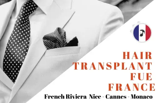 Hair Transplant FUE France