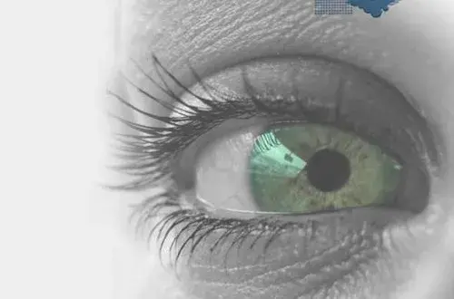 Centre de Chirurgie Refractive